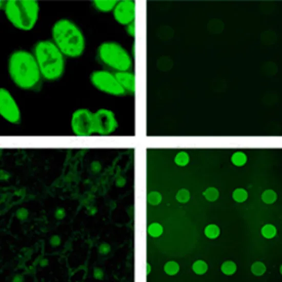 myositis profile extended igg: 16 antigen test